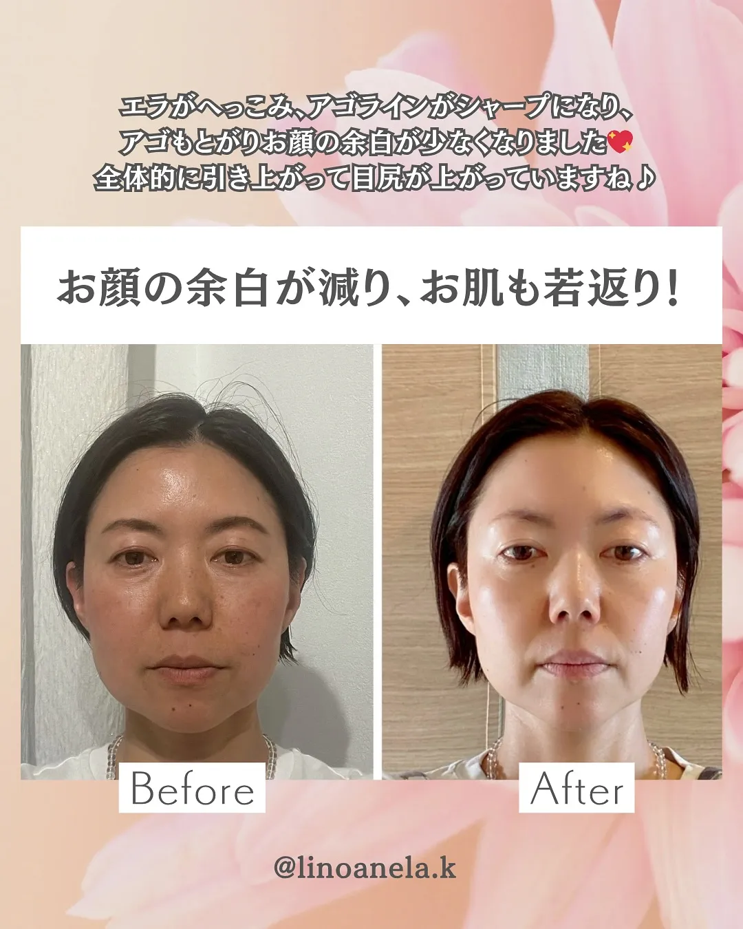 ◀︎他の投稿はコチラから
